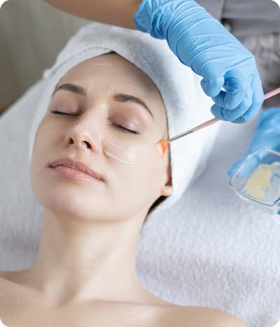 Chemical peel treatment