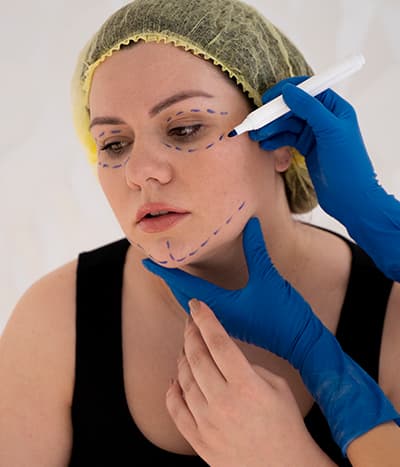 Hyperpigmented lesion treatment