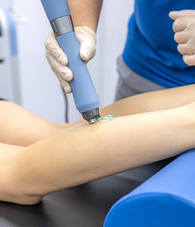 Laser leg vein removal treatment